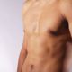 Ginecomastia